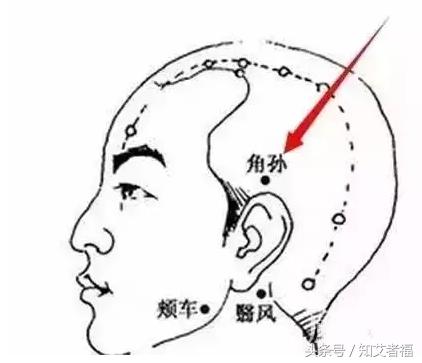 艾灸头部可以治疗白发吗,艾灸哪个穴位可以使白头发变黑