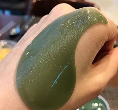 激光去眼袋恢复过程照片,激光去眼袋最真实的经历