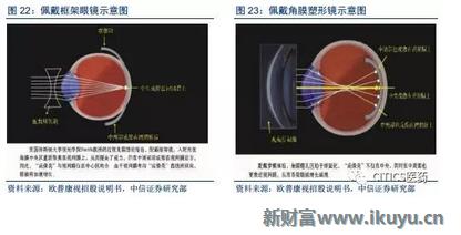 中国眼科治疗近视眼最新突破,国内眼科青光眼