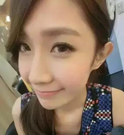 太阳穴凹陷的女人怎么破解,太阳穴凹陷的小妙招