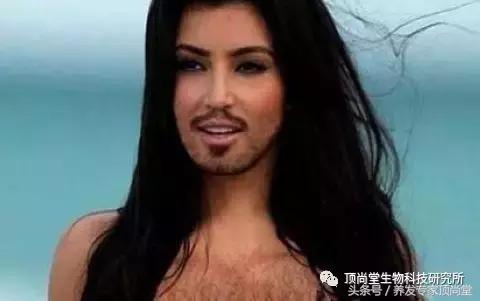 怎样降低雄性激素减少脱发,男性雄性激素脱发的治疗方法