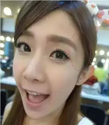 太阳穴凹陷的女人怎么破解,太阳穴凹陷的小妙招