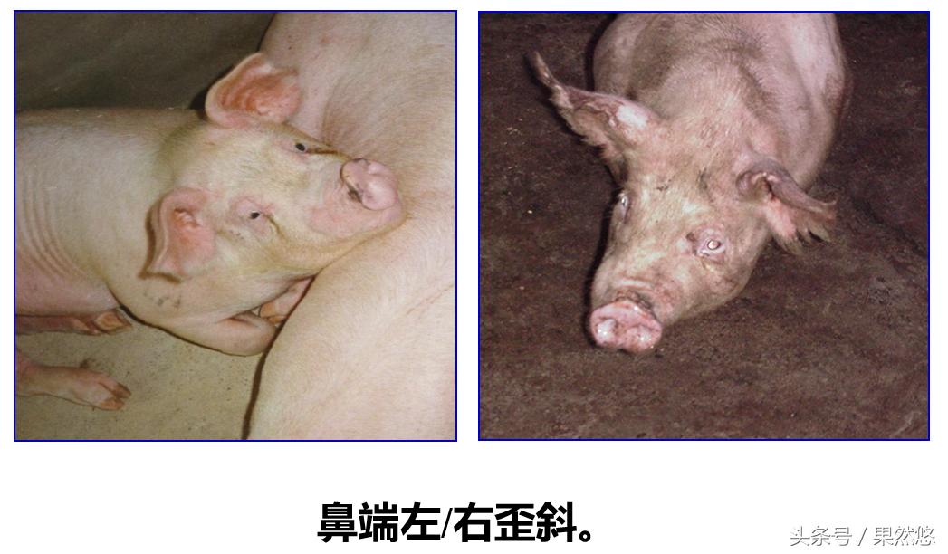 鼻子歪了有什么办法,鼻子歪用针矫正