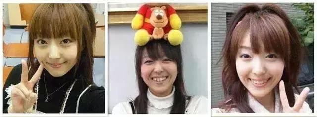 霓虹人民牙齿烂，居然引起了国际讨论背后原因才是父母该重视的