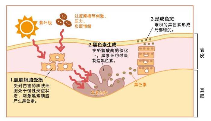 成分控美白,成分分析美白精华