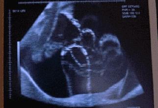 生男生女随心控制？朋友圈爆款“神药”的真相竟然是这样