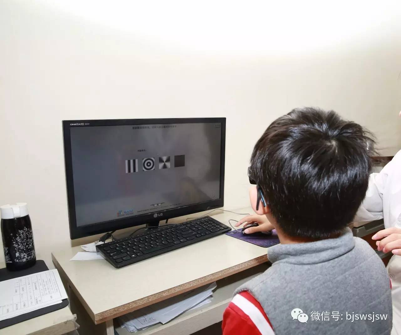 儿童弱视缺乏立体视觉,单眼弱视怎样训练双眼立体感呢