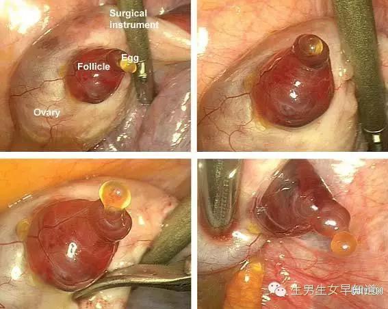 好孕2016！汤唯宣布怀孕啦！女神的小猴子是这样来的！