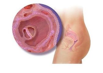 怀孕30周爱做一些奇怪的梦,孕妈怀孕期间做可怕的梦