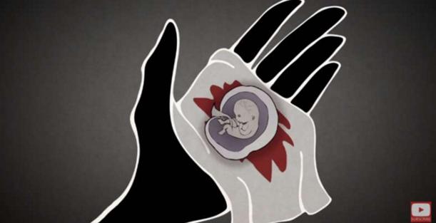 堕胎手术详细流程,女性堕胎手术的可怕真相