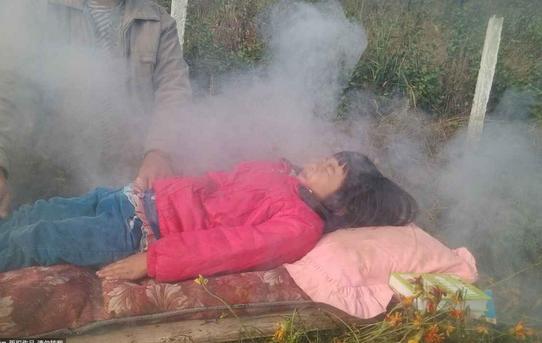 为重症贫血的女儿他自创火烤疗法还无师自通的学了《本草纲目》