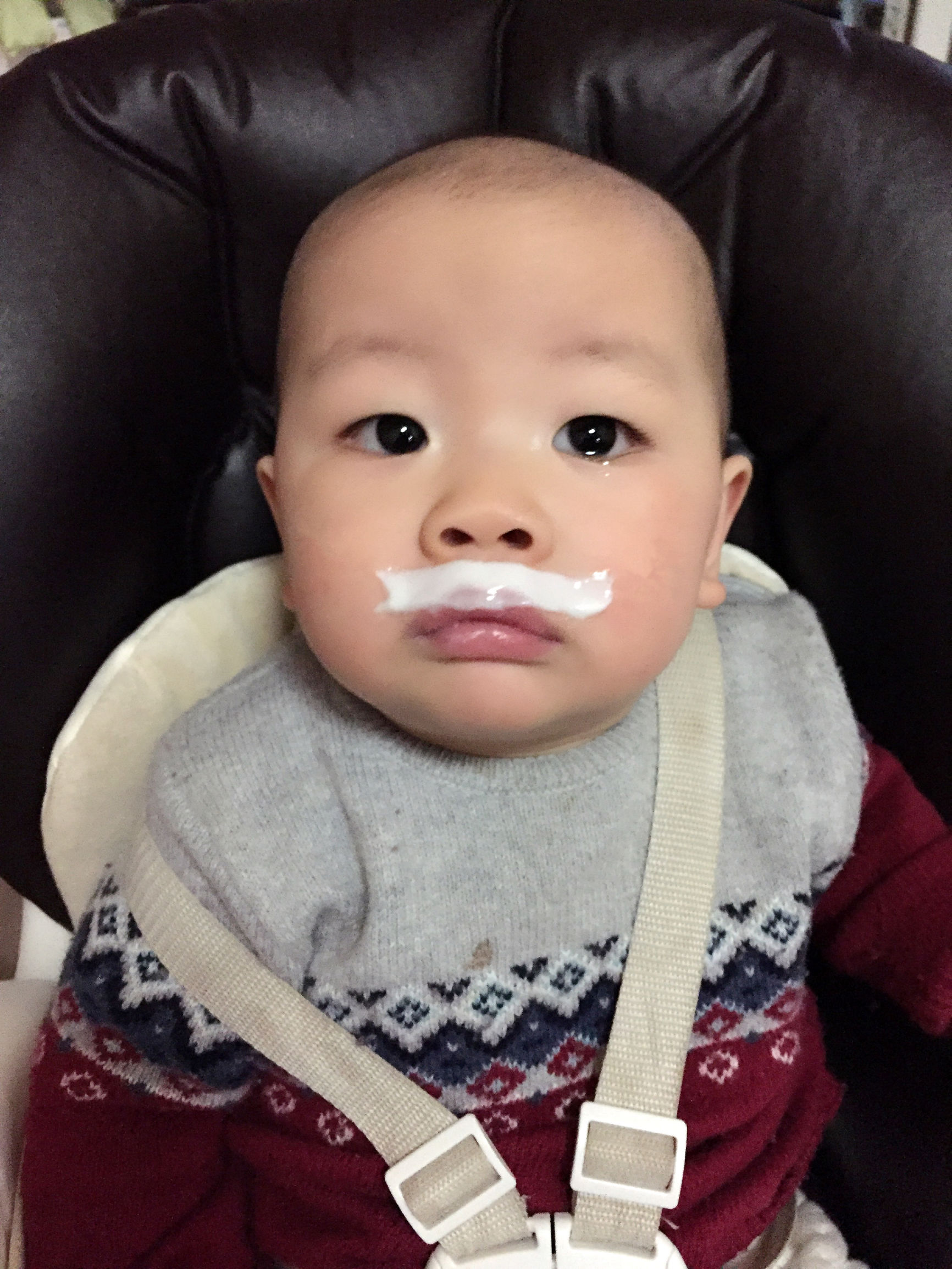 小孩脸湿疹皮肤损伤怎么修复,小婴儿皮肤湿疹