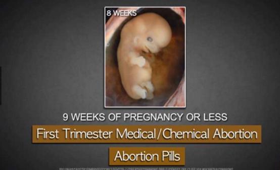 堕胎手术详细流程,女性堕胎手术的可怕真相