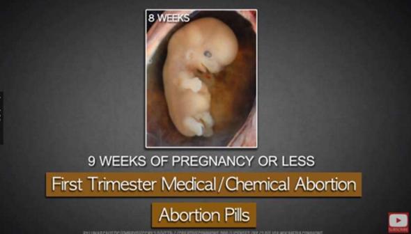 堕胎手术详细流程,女性堕胎手术的可怕真相