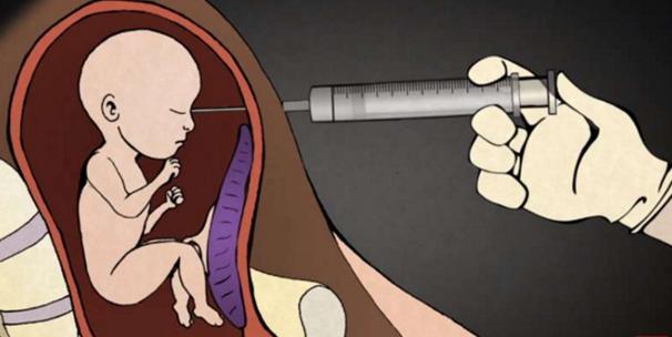 堕胎手术详细流程,女性堕胎手术的可怕真相