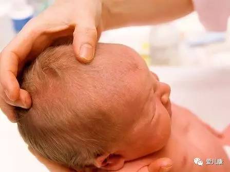 专家在线丨囟门早闭真的会影响脑发育吗？宝宝头顶“忽闪门”的秘密即将揭晓……