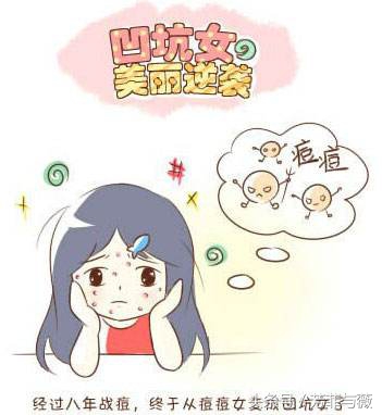 现在去除痘印的最有效方法,祛痘印小妙招很方便有效