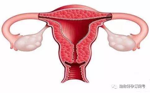 子宫内膜炎会引起子宫回声不均吗,子宫内膜炎原因中医解析