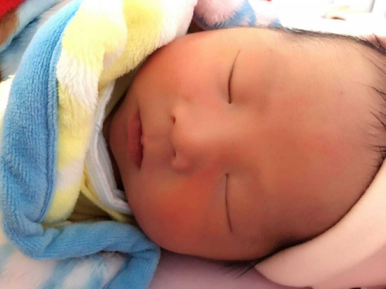 胎儿胎动频繁医生建议剖腹产,胎心异常剖腹产