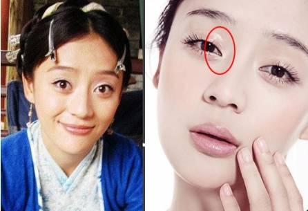 开眼角是把眼睛变大还是变长,开眼角是能让眼睛变长还是变大