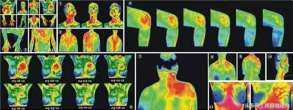 国之神器—医用红外健康测评技术，看见的“人体健康预报云图”