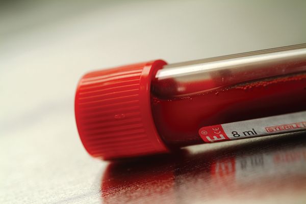 白细胞减少已经10年了应该怎么办,不明原因的白细胞减少能治好吗