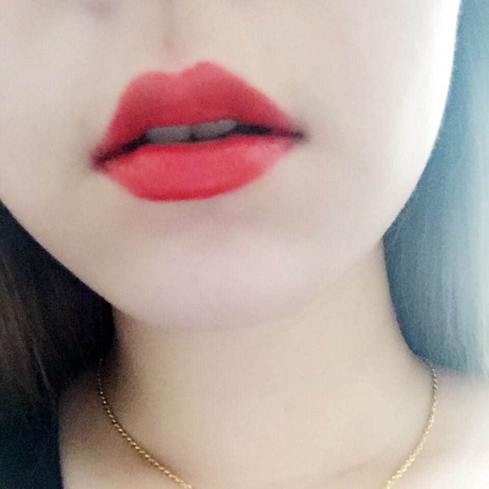 很多人嘴唇上有一道疤,为什么上嘴唇会多出一点肉