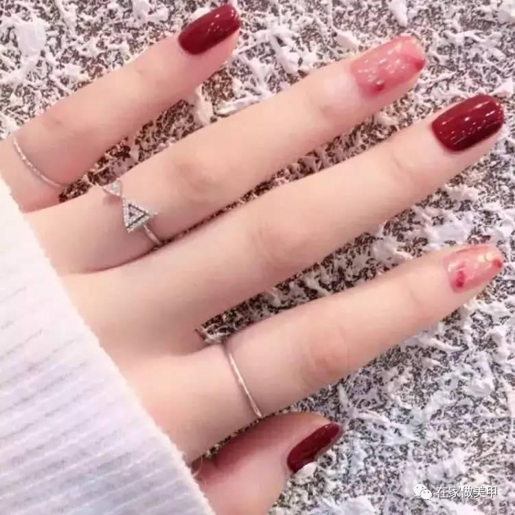 玛蒂被折断手指,玛蒂折断手指