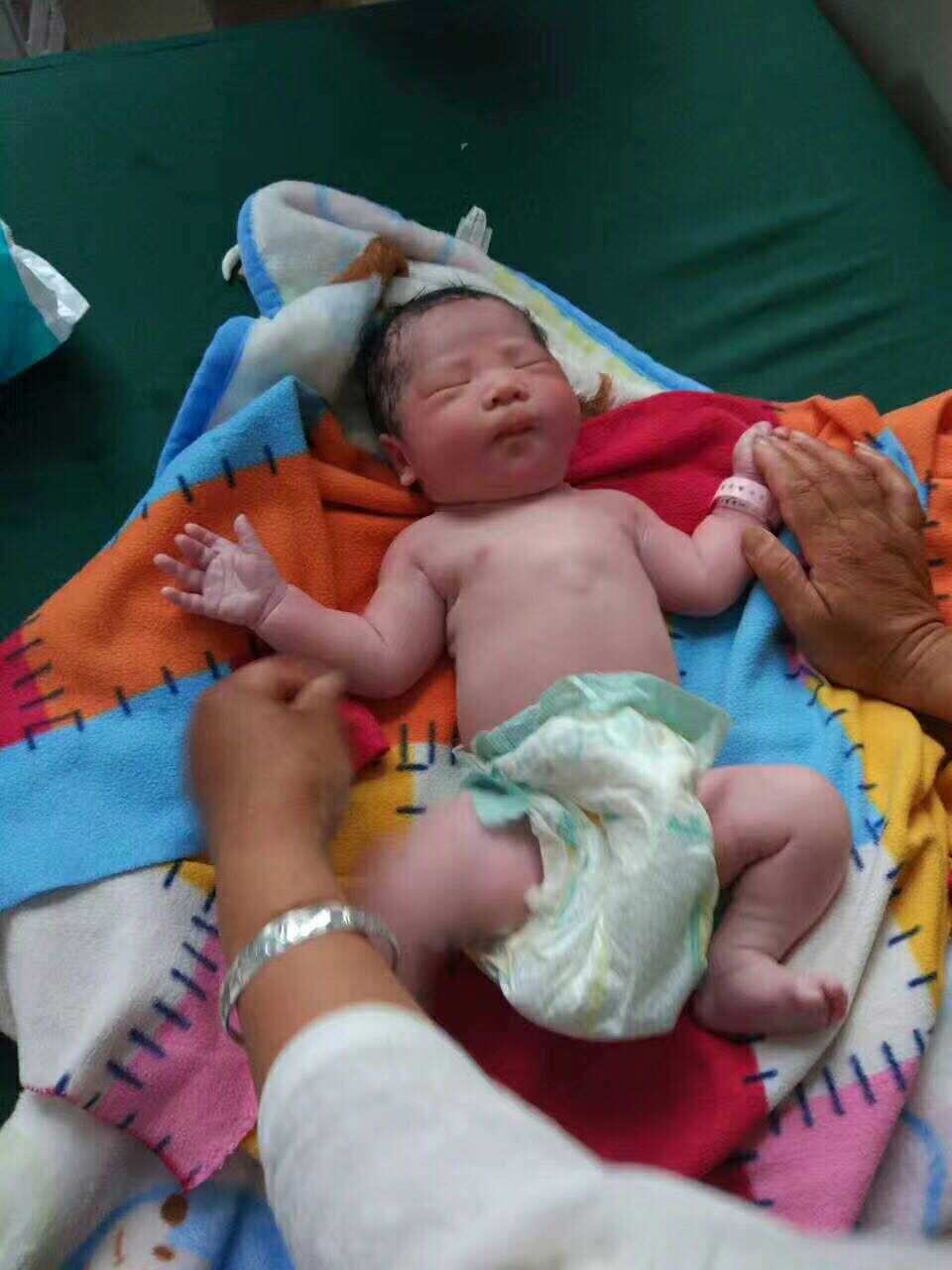 胎儿胎动频繁医生建议剖腹产,胎心异常剖腹产