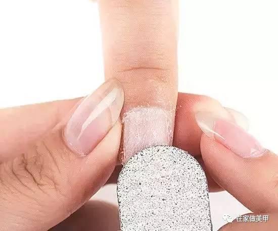 玛蒂被折断手指,玛蒂折断手指