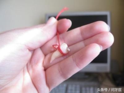 拔牙后为什么还一直流血,拔牙压迫止血后还一直流血