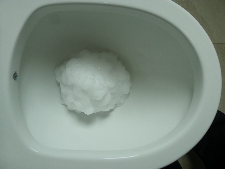 怎么解决马桶里的水溅到屁屁,马桶如何解决水花飞溅