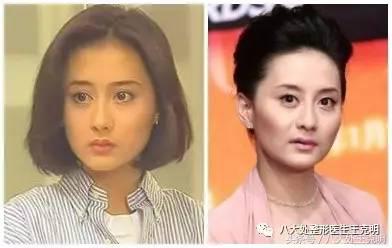 杨紫的法令纹能消除吗,杨紫法令纹很深怎么回事