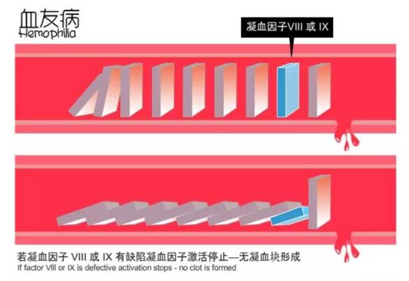 有血友病遗传生孩子有什么危险,一受伤就血流不止的病叫什么