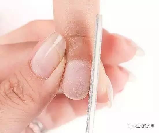 玛蒂被折断手指,玛蒂折断手指