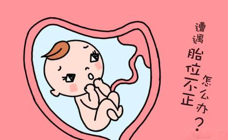 孕妈请关注最容易引起胎儿畸形,孕妈臀位