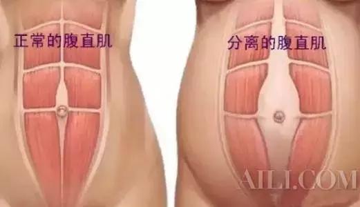 产后腰痛，都是麻醉惹的祸？事实上……