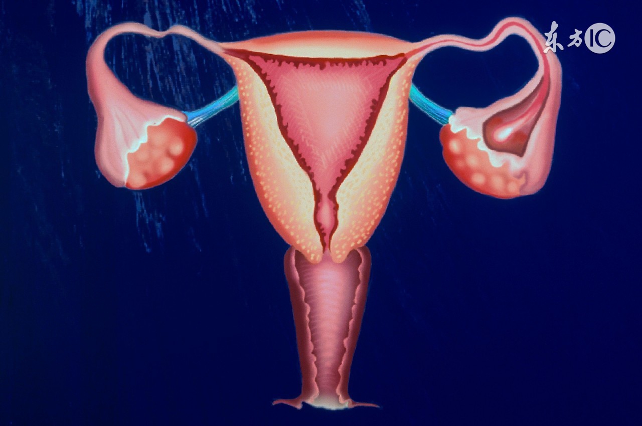 hpv和tct都是阳性一定是宫颈癌吗,体检hpv会误差吗