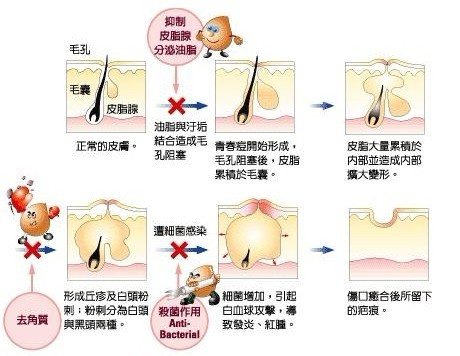 生理期特别想做什么,荷尔蒙旺盛长痘痘怎么办