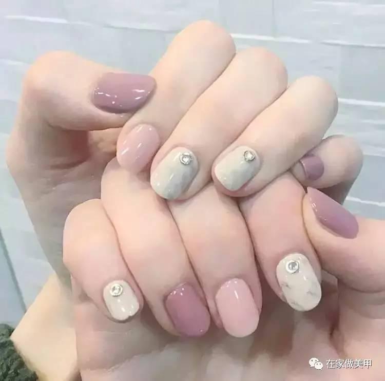 玛蒂被折断手指,玛蒂折断手指