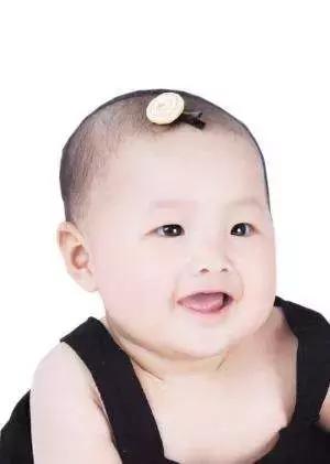 8个月宝宝头发稀少,小宝宝头发又黄又稀少怎么办