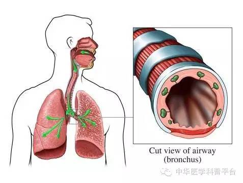 支气管哮喘的用药有哪些,哮喘每周一次连续两年的治疗