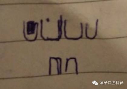 儿童牙齿补牙什么年龄最合适,一岁半宝宝补牙可以马上涂氟吗