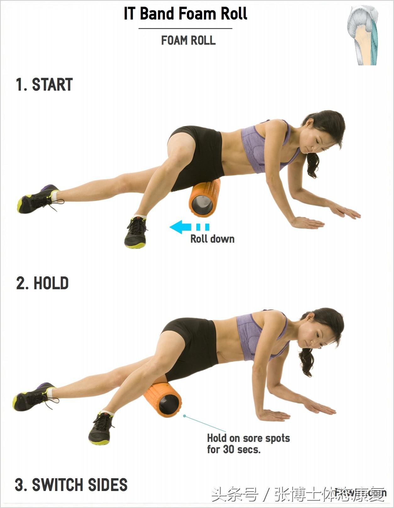 体态纠正膝内扣,膝关节外翻是o型腿吗