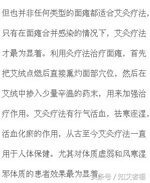 艾灸治疗面瘫效果好吗,艾灸治疗面瘫的偏方