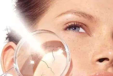 激素依赖性皮炎夏季更严重,激素依赖性皮炎好了该怎么护理