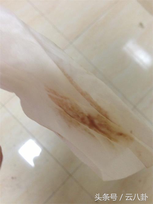 怀孕两个月身体一直流咖啡色东西，建档时医生说出一句话当场吓懵了