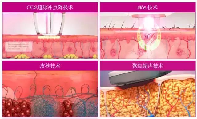 中国市场战略地位仅次美国，赛*龙诺**：集结全部产品线强塑“整体解决方案”