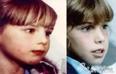 用嘴呼吸的对容貌的影响,用嘴呼吸会导致什么面容