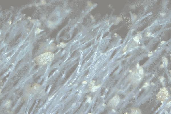 祛除黑头粉刺痘痘螨虫收缩毛孔,鼻子黑头多脸上毛孔大是螨虫